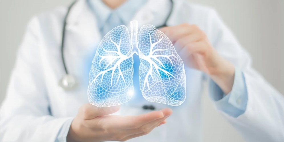 Image is not available