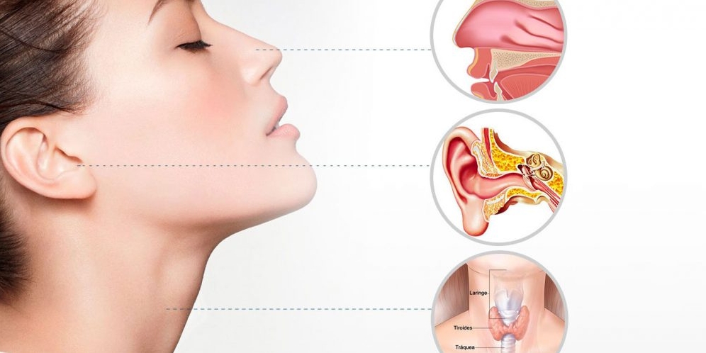 Image is not available